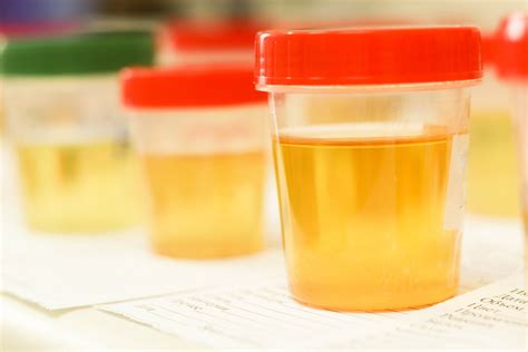 is a lab urine test harder to pass|how to detect false urine.